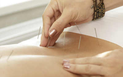 Acupuncture & Yoga for Low Back Pain- Part I
